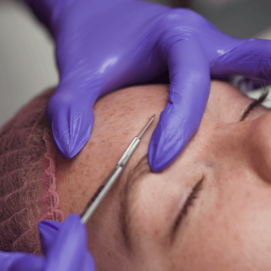 Dermaplaning